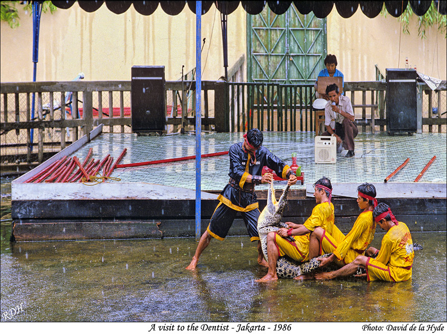 A visit to the Dentist - Jakarta 1986